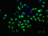 Immunofluorescence staining of Hela cells with CSB-PA856440LA01HU at 1:166, counter-stained with DAPI. The cells were fixed in 4% formaldehyde, permeabilized using 0.2% Triton X-100 and blocked in 10% normal Goat Serum. The cells were then incubated with the antibody overnight at 4°C. The secondary antibody was Alexa Fluor 488-congugated AffiniPure Goat Anti-Rabbit IgG (H+L) .