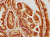 IHC image of CSB-PA004940LA01HU diluted at 1:300 and staining in paraffin-embedded human prostate tissue performed on a Leica BondTM system. After dewaxing and hydration, antigen retrieval was mediated by high pressure in a citrate buffer (pH 6.0) . Section was blocked with 10% normal goat serum 30min at RT. Then primary antibody (1% BSA) was incubated at 4°C overnight. The primary is detected by a biotinylated secondary antibody and visualized using an HRP conjugated SP system.