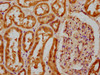 IHC image of CSB-PA005746LA01HU diluted at 1:100 and staining in paraffin-embedded human kidney tissue performed on a Leica BondTM system. After dewaxing and hydration, antigen retrieval was mediated by high pressure in a citrate buffer (pH 6.0) . Section was blocked with 10% normal goat serum 30min at RT. Then primary antibody (1% BSA) was incubated at 4°C overnight. The primary is detected by a biotinylated secondary antibody and visualized using an HRP conjugated SP system.