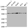 Western Blot<br />
 Positive WB detected in: RAW264.7 whole cell lysate, SH-SY5Y whole cell lysate, HepG2 whole cell lysate, Hela whole cell lysate, MCF-7 whole cell lysate<br />
 All lanes: MATN3 antibody at 4µg/ml<br />
 Secondary<br />
 Goat polyclonal to rabbit IgG at 1/50000 dilution<br />
 Predicted band size: 53, 49 kDa<br />
 Observed band size: 53 kDa<br />