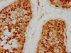 IHC image of CSB-PA018769LA01HU diluted at 1:200 and staining in paraffin-embedded human testis tissue performed on a Leica BondTM system. After dewaxing and hydration, antigen retrieval was mediated by high pressure in a citrate buffer (pH 6.0) . Section was blocked with 10% normal goat serum 30min at RT. Then primary antibody (1% BSA) was incubated at 4°C overnight. The primary is detected by a biotinylated secondary antibody and visualized using an HRP conjugated SP system.