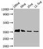 Western Blot<br />
 Positive WB detected in Recombinant protein<br />
 All lanes: BLLF3 antibody at 3.3µg/ml<br />
 Secondary<br />
 Goat polyclonal to rabbit IgG at 1/50000 dilution<br />
 Predicted band size: 35 kDa<br />
 Observed band size: 35 kDa<br />