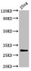 Western Blot<br />
 Positive WB detected in Recombinant protein<br />
 All lanes: S antibody at 5.7µg/ml<br />
 Secondary<br />
 Goat polyclonal to rabbit IgG at 1/50000 dilution<br />
 Predicted band size: 29 kDa<br />
 Observed band size: 29 kDa<br />