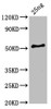 Western Blot<br />
 Positive WB detected in Recombinant protein<br />
 All lanes: HA-33 antibody at 6µg/ml<br />
 Secondary<br />
 Goat polyclonal to rabbit IgG at 1/50000 dilution<br />
 Predicted band size: 54 kDa<br />
 Observed band size: 54 kDa<br />