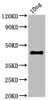 Western Blot<br />
 Positive WB detected in Recombinant protein<br />
 All lanes: NS1 antibody at 2.7µg/ml<br />
 Secondary<br />
 Goat polyclonal to rabbit IgG at 1/50000 dilution<br />
 Predicted band size: 45 kDa<br />
 Observed band size: 45 kDa<br />