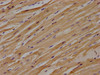 IHC image of CSB-PA013049OA01HU diluted at 1:100 and staining in paraffin-embedded human heart tissue performed on a Leica BondTM system. After dewaxing and hydration, antigen retrieval was mediated by high pressure in a citrate buffer (pH 6.0) . Section was blocked with 10% normal goat serum 30min at RT. Then primary antibody (1% BSA) was incubated at 4°C overnight. The primary is detected by a biotinylated secondary antibody and visualized using an HRP conjugated SP system.