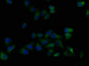 Immunofluorescence staining of Hela cells with CSB-PA013051OA01HU at 1:50, counter-stained with DAPI. The cells were fixed in 4% formaldehyde, permeabilized using 0.2% Triton X-100 and blocked in 10% normal Goat Serum. The cells were then incubated with the antibody overnight at 4°C. The secondary antibody was Alexa Fluor 488-congugated AffiniPure Goat Anti-Rabbit IgG (H+L) .