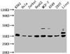 Western Blot<br />
 Positive WB detected in: K562 whole cell lysate, Hela whole cell lysate, Jurkat whole cell lysate, HepG2 whole cell lysate, MCF-7 whole cell lysate, A549 whole cell lysate, 293T whole cell lysate, Rat liver tissue<br />
 All lanes: PSMD14 antibody at 1:2000<br />
 Secondary<br />
 Goat polyclonal to rabbit IgG at 1/50000 dilution<br />
 Predicted band size: 35 kDa<br />
 Observed band size: 35 kDa<br />