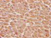 IHC image of CSB-PA018904OA01HU diluted at 1:100 and staining in paraffin-embedded human heart tissue performed on a Leica BondTM system. After dewaxing and hydration, antigen retrieval was mediated by high pressure in a citrate buffer (pH 6.0) . Section was blocked with 10% normal goat serum 30min at RT. Then primary antibody (1% BSA) was incubated at 4°C overnight. The primary is detected by a biotinylated secondary antibody and visualized using an HRP conjugated SP system.