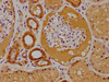 IHC image of CSB-PA018996LA01HU diluted at 1:100 and staining in paraffin-embedded human kidney tissue performed on a Leica BondTM system. After dewaxing and hydration, antigen retrieval was mediated by high pressure in a citrate buffer (pH 6.0) . Section was blocked with 10% normal goat serum 30min at RT. Then primary antibody (1% BSA) was incubated at 4°C overnight. The primary is detected by a biotinylated secondary antibody and visualized using an HRP conjugated SP system.