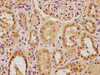 IHC image of CSB-PA020060NA01HU diluted at 1:100 and staining in paraffin-embedded human kidney tissue performed on a Leica BondTM system. After dewaxing and hydration, antigen retrieval was mediated by high pressure in a citrate buffer (pH 6.0) . Section was blocked with 10% normal goat serum 30min at RT. Then primary antibody (1% BSA) was incubated at 4°C overnight. The primary is detected by a biotinylated secondary antibody and visualized using an HRP conjugated SP system.