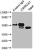 Immunoprecipitating CSNK2A3 in Hela whole cell lysate<br />
 Lane 1: Rabbit control IgG instead of CSB-PA086427LA01HU in Hela whole cell lysate.
 For western blotting, a HRP-conjugated Protein G antibody was used as the secondary antibody (1/50000) <br />
 Lane 2: CSB-PA086427LA01HU (5µg) + Hela whole cell lysate (0.5mg) <br />
 Lane 3: Hela whole cell lysate (20µg) <br />
