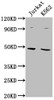 Western Blot<br />
 Positive WB detected in: Jurkat whole cell lysate, K562 whole cell lysate<br />
 All lanes: PSMD6 antibody at 1:2000<br />
 Secondary<br />
 Goat polyclonal to rabbit IgG at 1/50000 dilution<br />
 Predicted band size: 46, 42, 52 kDa<br />
 Observed band size: 46 kDa<br />