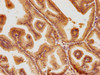 IHC image of CSB-PA614875PA01HU diluted at 1:100 and staining in paraffin-embedded human prostate tissue performed on a Leica BondTM system. After dewaxing and hydration, antigen retrieval was mediated by high pressure in a citrate buffer (pH 6.0) . Section was blocked with 10% normal goat serum 30min at RT. Then primary antibody (1% BSA) was incubated at 4°C overnight. The primary is detected by a biotinylated secondary antibody and visualized using an HRP conjugated SP system.
