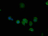 Immunofluorescence staining of MCF-7 cells with CSB-PA614875PA01HU at 1:50, counter-stained with DAPI. The cells were fixed in 4% formaldehyde, permeabilized using 0.2% Triton X-100 and blocked in 10% normal Goat Serum. The cells were then incubated with the antibody overnight at 4°C. The secondary antibody was Alexa Fluor 488-congugated AffiniPure Goat Anti-Rabbit IgG (H+L) .