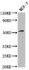 Western Blot<br />
 Positive WB detected in: MCF-7 whole cell lysate<br />
 All lanes: PPM1J antibody at 1:2000<br />
 Secondary<br />
 Goat polyclonal to rabbit IgG at 1/50000 dilution<br />
 Predicted band size: 55, 34 kDa<br />
 Observed band size: 55 kDa<br />