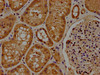 IHC image of CSB-PA686382LA01HU diluted at 1:100 and staining in paraffin-embedded human kidney tissue performed on a Leica BondTM system. After dewaxing and hydration, antigen retrieval was mediated by high pressure in a citrate buffer (pH 6.0) . Section was blocked with 10% normal goat serum 30min at RT. Then primary antibody (1% BSA) was incubated at 4°C overnight. The primary is detected by a biotinylated secondary antibody and visualized using an HRP conjugated SP system.