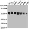 Western Blot<br />
 Positive WB detected in: Hela whole cell lysate, MCF-7 whole cell lysate, K562 whole cell lysate, Jurkat whole cell lysate, Raji whole cell lysate, 293T whole cell lysate, A549 whole cell lysate<br />
 All lanes: DNAJA3 antibody at 1:2000<br />
 Secondary<br />
 Goat polyclonal to rabbit IgG at 1/50000 dilution<br />
 Predicted band size: 53, 50, 34 kDa<br />
 Observed band size: 53 kDa<br />