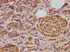 IHC image of CSB-PA836207LA01HU diluted at 1:400 and staining in paraffin-embedded human pancreatic cancer performed on a Leica BondTM system. After dewaxing and hydration, antigen retrieval was mediated by high pressure in a citrate buffer (pH 6.0) . Section was blocked with 10% normal goat serum 30min at RT. Then primary antibody (1% BSA) was incubated at 4°C overnight. The primary is detected by a biotinylated secondary antibody and visualized using an HRP conjugated SP system.