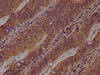 IHC image of CSB-PA002155LA01HU diluted at 1:400 and staining in paraffin-embedded human colon cancer performed on a Leica BondTM system. After dewaxing and hydration, antigen retrieval was mediated by high pressure in a citrate buffer (pH 6.0) . Section was blocked with 10% normal goat serum 30min at RT. Then primary antibody (1% BSA) was incubated at 4°C overnight. The primary is detected by a biotinylated secondary antibody and visualized using an HRP conjugated SP system.