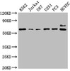 Western Blot<br />
 Positive WB detected in: K562 whole cell lysate, Jurkat whole cell lysate, U87 whole cell lysate, U251 whole cell lysate, PC3 whole cell lysate, HUVEC whole cell lysate<br />
 All lanes: NT5E antibody at 1:2000<br />
 Secondary<br />
 Goat polyclonal to rabbit IgG at 1/50000 dilution<br />
 Predicted band size: 64, 58 kDa<br />
 Observed band size: 64 kDa<br />