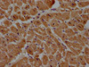 IHC image of CSB-PA621878LA01HU diluted at 1:100 and staining in paraffin-embedded human heart tissue performed on a Leica BondTM system. After dewaxing and hydration, antigen retrieval was mediated by high pressure in a citrate buffer (pH 6.0) . Section was blocked with 10% normal goat serum 30min at RT. Then primary antibody (1% BSA) was incubated at 4°C overnight. The primary is detected by a biotinylated secondary antibody and visualized using an HRP conjugated SP system.