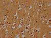 IHC image of CSB-PA722568LA01HU diluted at 1:300 and staining in paraffin-embedded human brain tissue performed on a Leica BondTM system. After dewaxing and hydration, antigen retrieval was mediated by high pressure in a citrate buffer (pH 6.0) . Section was blocked with 10% normal goat serum 30min at RT. Then primary antibody (1% BSA) was incubated at 4°C overnight. The primary is detected by a biotinylated secondary antibody and visualized using an HRP conjugated SP system.