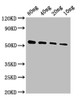 Western Blot<br />
 Positive WB detected in Recombinant protein<br />
 All lanes: VP40 antibody at 1:2000<br />
 Secondary<br />
 Goat polyclonal to rabbit IgG at 1/50000 dilution<br />
 Predicted band size: 51 kDa<br />
 Observed band size: 51 kDa<br />