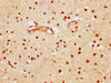 IHC image of CSB-PA002799LA01HU diluted at 1:600 and staining in paraffin-embedded human brain tissue performed on a Leica BondTM system. After dewaxing and hydration, antigen retrieval was mediated by high pressure in a citrate buffer (pH 6.0) . Section was blocked with 10% normal goat serum 30min at RT. Then primary antibody (1% BSA) was incubated at 4°C overnight. The primary is detected by a biotinylated secondary antibody and visualized using an HRP conjugated SP system.