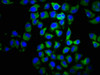 Immunofluorescence staining of Hela cells with CSB-PA004841LA01HU at 1:100, counter-stained with DAPI. The cells were fixed in 4% formaldehyde, permeabilized using 0.2% Triton X-100 and blocked in 10% normal Goat Serum. The cells were then incubated with the antibody overnight at 4°C. The secondary antibody was Alexa Fluor 488-congugated AffiniPure Goat Anti-Rabbit IgG (H+L) .