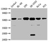 Western Blot<br />
 Positive WB detected in: Jurkat whole cell lysate, HL-60 whole cell lysate, 293 whole cell lysate, SH-SY5Y whole cell lysate, Hela whole cell lysate, PC3 whole cell lysate<br />
 All lanes: CYP21A2 antibody at 1:500<br />
 Secondary<br />
 Goat polyclonal to rabbit IgG at 1/50000 dilution<br />
 Predicted band size: 56, 53 kDa<br />
 Observed band size: 56 kDa<br />