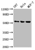 Western Blot<br />
 Positive WB detected in: U87 whole cell lysate, Hela whole cell lysate, MCF-7 whole cell lysate<br />
 All lanes: MEF2A antibody at 1:500<br />
 Secondary<br />
 Goat polyclonal to rabbit IgG at 1/50000 dilution<br />
 Predicted band size: 55, 54, 47, 46 kDa<br />
 Observed band size: 55 kDa<br />