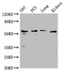 Western Blot<br />
 Positive WB detected in: U87 whole cell lysate, PC3 whole cell lysate, Mouse lung tissue, Mouse kidney tissue<br />
 All lanes: PPP5C antibody at 1:1000<br />
 Secondary<br />
 Goat polyclonal to rabbit IgG at 1/50000 dilution<br />
 Predicted band size: 57 kDa<br />
 Observed band size: 57 kDa<br />