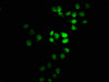 Immunofluorescence staining of Hela cells with CSB-PA023233LA01HU at 1:100, counter-stained with DAPI. The cells were fixed in 4% formaldehyde, permeabilized using 0.2% Triton X-100 and blocked in 10% normal Goat Serum. The cells were then incubated with the antibody overnight at 4°C. The secondary antibody was Alexa Fluor 488-congugated AffiniPure Goat Anti-Rabbit IgG (H+L) .