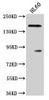 Western Blot<br />
 Positive WB detected in: HL60 whole cell lysate<br />
 All lanes: ROCK1 antibody at 1:2000<br />
 Secondary<br />
 Goat polyclonal to rabbit IgG at 1/50000 dilution<br />
 Predicted band size: 159 kDa<br />
 Observed band size: 159 kDa<br />