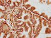 IHC image of CSB-PA622788LA01HU diluted at 1:300 and staining in paraffin-embedded human prostate tissue performed on a Leica BondTM system. After dewaxing and hydration, antigen retrieval was mediated by high pressure in a citrate buffer (pH 6.0) . Section was blocked with 10% normal goat serum 30min at RT. Then primary antibody (1% BSA) was incubated at 4°C overnight. The primary is detected by a biotinylated secondary antibody and visualized using an HRP conjugated SP system.