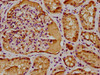 IHC image of CSB-PA757659LA01HU diluted at 1:300 and staining in paraffin-embedded human kidney tissue performed on a Leica BondTM system. After dewaxing and hydration, antigen retrieval was mediated by high pressure in a citrate buffer (pH 6.0) . Section was blocked with 10% normal goat serum 30min at RT. Then primary antibody (1% BSA) was incubated at 4°C overnight. The primary is detected by a biotinylated secondary antibody and visualized using an HRP conjugated SP system.