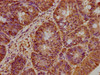 IHC image of CSB-PA757659LA01HU diluted at 1:300 and staining in paraffin-embedded human colon cancer performed on a Leica BondTM system. After dewaxing and hydration, antigen retrieval was mediated by high pressure in a citrate buffer (pH 6.0) . Section was blocked with 10% normal goat serum 30min at RT. Then primary antibody (1% BSA) was incubated at 4°C overnight. The primary is detected by a biotinylated secondary antibody and visualized using an HRP conjugated SP system.