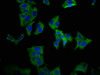 Immunofluorescence staining of HepG2 cells with CSB-PA880079LA01HU at 1:66, counter-stained with DAPI. The cells were fixed in 4% formaldehyde, permeabilized using 0.2% Triton X-100 and blocked in 10% normal Goat Serum. The cells were then incubated with the antibody overnight at 4°C. The secondary antibody was Alexa Fluor 488-congugated AffiniPure Goat Anti-Rabbit IgG (H+L) .
