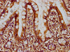 IHC image of CSB-PA007512LA01HU diluted at 1:300 and staining in paraffin-embedded human small intestine tissue performed on a Leica BondTM system. After dewaxing and hydration, antigen retrieval was mediated by high pressure in a citrate buffer (pH 6.0) . Section was blocked with 10% normal goat serum 30min at RT. Then primary antibody (1% BSA) was incubated at 4°C overnight. The primary is detected by a biotinylated secondary antibody and visualized using an HRP conjugated SP system. IHC image of CSB-PA007512LA01HU diluted at 1:300 and staining in paraffin-embedded human small intestine tissue performed on a Leica BondTM system. After dewaxing and hydration, antigen retrieval was mediated by high pressure in a citrate buffer (pH 6.0) . Section was blocked with 10% normal goat serum 30min at RT. Then primary antibody (1% BSA) was incubated at 4°C overnight. The primary is detected by a biotinylated secondary antibody and visualized using an HRP conjugated SP system.