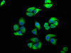 Immunofluorescence staining of Hela cells with CSB-PA007512LA01HU at 1:100, counter-stained with DAPI. The cells were fixed in 4% formaldehyde, permeabilized using 0.2% Triton X-100 and blocked in 10% normal Goat Serum. The cells were then incubated with the antibody overnight at 4°C. The secondary antibody was Alexa Fluor 488-congugated AffiniPure Goat Anti-Rabbit IgG (H+L) . Immunofluorescence staining of Hela cells with CSB-PA007512LA01HU at 1:100, counter-stained with DAPI. The cells were fixed in 4% formaldehyde, permeabilized using 0.2% Triton X-100 and blocked in 10% normal Goat Serum. The cells were then incubated with the antibody overnight at 4°C. The secondary antibody was Alexa Fluor 488-congugated AffiniPure Goat Anti-Rabbit IgG (H+L) .