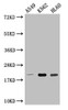 Western Blot<br />
 Positive WB detected in: A549 whole cell lysate, K562 whole cell lysate, HL60 whole cell lysate<br />
 All lanes: POLR2G antibody at 1:2000<br />
 Secondary<br />
 Goat polyclonal to rabbit IgG at 1/50000 dilution<br />
 Predicted band size: 20 kDa<br />
 Observed band size: 20 kDa<br />
