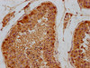 IHC image of CSB-PA882173LA01HU diluted at 1:300 and staining in paraffin-embedded human testis tissue performed on a Leica BondTM system. After dewaxing and hydration, antigen retrieval was mediated by high pressure in a citrate buffer (pH 6.0) . Section was blocked with 10% normal goat serum 30min at RT. Then primary antibody (1% BSA) was incubated at 4°C overnight. The primary is detected by a biotinylated secondary antibody and visualized using an HRP conjugated SP system.