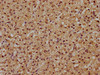 IHC image of CSB-PA896922LA01HU diluted at 1:500 and staining in paraffin-embedded human adrenal gland tissue performed on a Leica BondTM system. After dewaxing and hydration, antigen retrieval was mediated by high pressure in a citrate buffer (pH 6.0) . Section was blocked with 10% normal goat serum 30min at RT. Then primary antibody (1% BSA) was incubated at 4°C overnight. The primary is detected by a biotinylated secondary antibody and visualized using an HRP conjugated SP system. IHC image of CSB-PA896922LA01HU diluted at 1:500 and staining in paraffin-embedded human adrenal gland tissue performed on a Leica BondTM system. After dewaxing and hydration, antigen retrieval was mediated by high pressure in a citrate buffer (pH 6.0) . Section was blocked with 10% normal goat serum 30min at RT. Then primary antibody (1% BSA) was incubated at 4°C overnight. The primary is detected by a biotinylated secondary antibody and visualized using an HRP conjugated SP system.