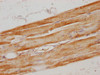 IHC image of CSB-PA015299HA01HU diluted at 1:100 and staining in paraffin-embedded human skeletal muscle tissue performed on a Leica BondTM system. After dewaxing and hydration, antigen retrieval was mediated by high pressure in a citrate buffer (pH 6.0) . Section was blocked with 10% normal goat serum 30min at RT. Then primary antibody (1% BSA) was incubated at 4°C overnight. The primary is detected by a biotinylated secondary antibody and visualized using an HRP conjugated SP system.