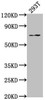 Western Blot<br />
 Positive WB detected in: 293T whole cell lysate<br />
 All lanes: PXN antibody at 1:2000<br />
 Secondary<br />
 Goat polyclonal to rabbit IgG at 1/50000 dilution<br />
 Predicted band size: 65, 61, 67, 47 kDa<br />
 Observed band size: 65 kDa<br /> Western Blot<br />
 Positive WB detected in: 293T whole cell lysate<br />
 All lanes: PXN antibody at 1:2000<br />
 Secondary<br />
 Goat polyclonal to rabbit IgG at 1/50000 dilution<br />
 Predicted band size: 65, 61, 67, 47 kDa<br />
 Observed band size: 65 kDa<br />