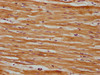 IHC image of CSB-PA022689LA01HU diluted at 1:600 and staining in paraffin-embedded human heart tissue performed on a Leica BondTM system. After dewaxing and hydration, antigen retrieval was mediated by high pressure in a citrate buffer (pH 6.0) . Section was blocked with 10% normal goat serum 30min at RT. Then primary antibody (1% BSA) was incubated at 4°C overnight. The primary is detected by a biotinylated secondary antibody and visualized using an HRP conjugated SP system.