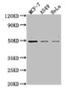 Western Blot<br />
 Positive WB detected in: MCF-7 whole cell lysate, A549 whole cell lysate, Hela whole cell lysate<br />
 All lanes: TSKU antibody at 1:2000<br />
 Secondary<br />
 Goat polyclonal to rabbit IgG at 1/50000 dilution<br />
 Predicted band size: 38 kDa<br />
 Observed band size: 49 kDa<br />