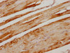 IHC image of CSB-PA025821PA01HU diluted at 1:300 and staining in paraffin-embedded human skeletal muscle tissue performed on a Leica BondTM system. After dewaxing and hydration, antigen retrieval was mediated by high pressure in a citrate buffer (pH 6.0) . Section was blocked with 10% normal goat serum 30min at RT. Then primary antibody (1% BSA) was incubated at 4°C overnight. The primary is detected by a biotinylated secondary antibody and visualized using an HRP conjugated SP system.