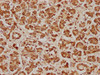 IHC image of CSB-PA620981LA01HU diluted at 1:100 and staining in paraffin-embedded human pancreatic tissue performed on a Leica BondTM system. After dewaxing and hydration, antigen retrieval was mediated by high pressure in a citrate buffer (pH 6.0) . Section was blocked with 10% normal goat serum 30min at RT. Then primary antibody (1% BSA) was incubated at 4°C overnight. The primary is detected by a biotinylated secondary antibody and visualized using an HRP conjugated SP system.